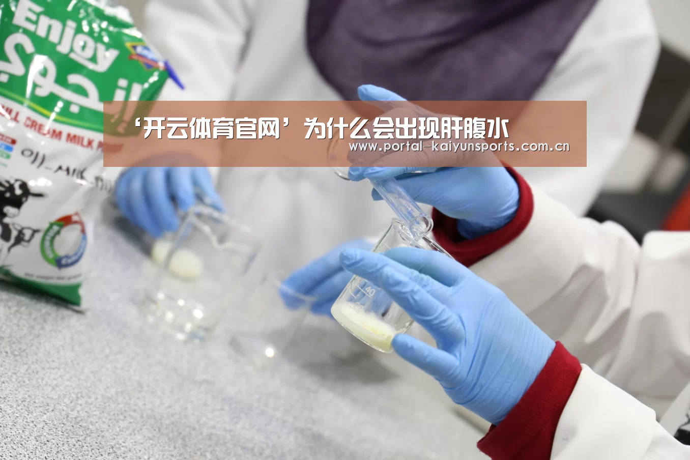 ‘开云体育官网’为什么会出现肝腹水(图2) 开云体育官网